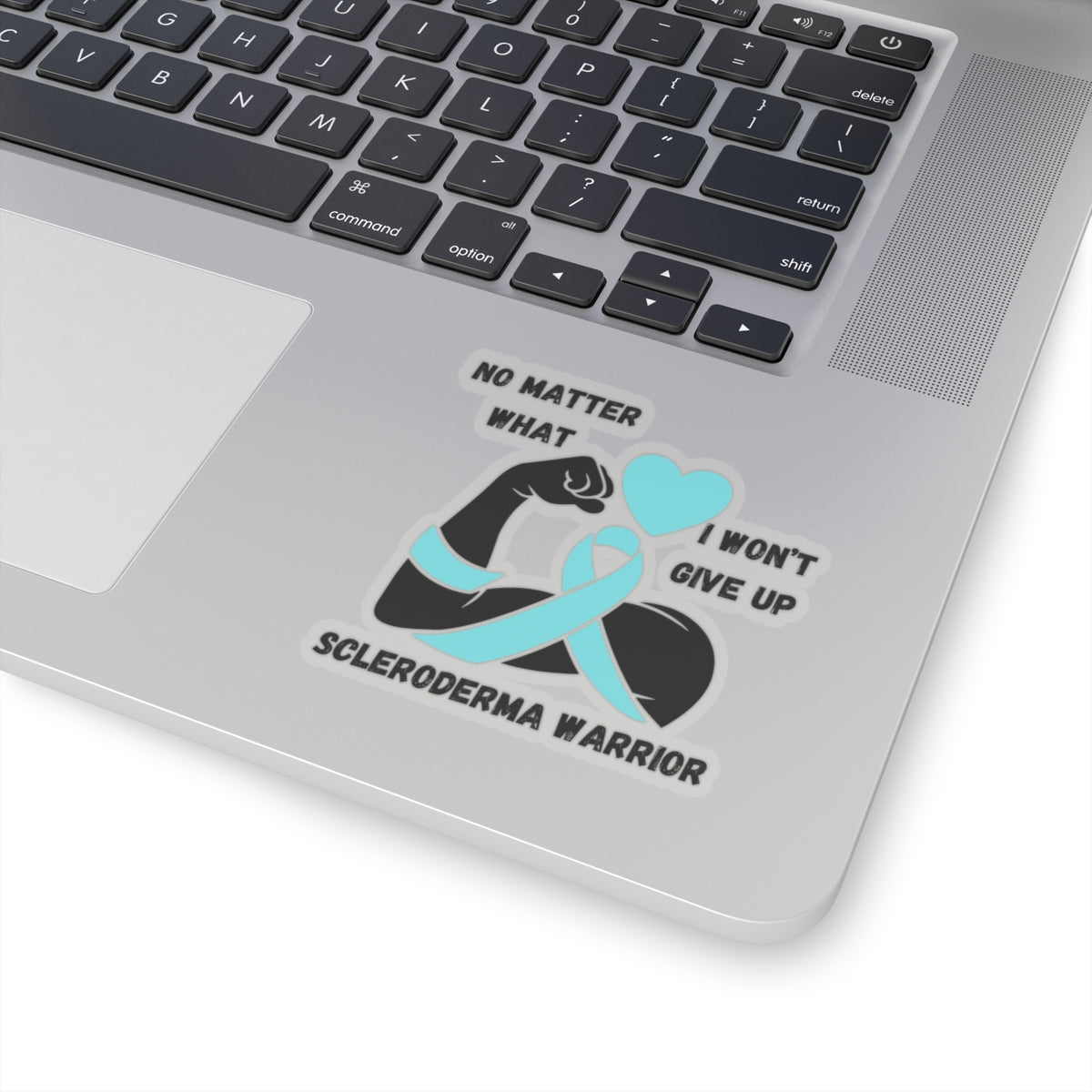 Scleroderma Awareness "I Won't Give Up"  Stickers