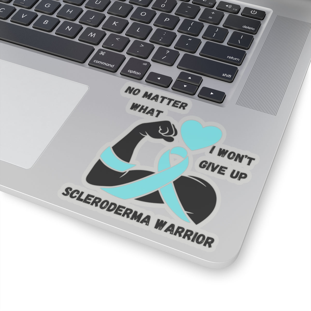 Scleroderma Awareness "I Won't Give Up"  Stickers