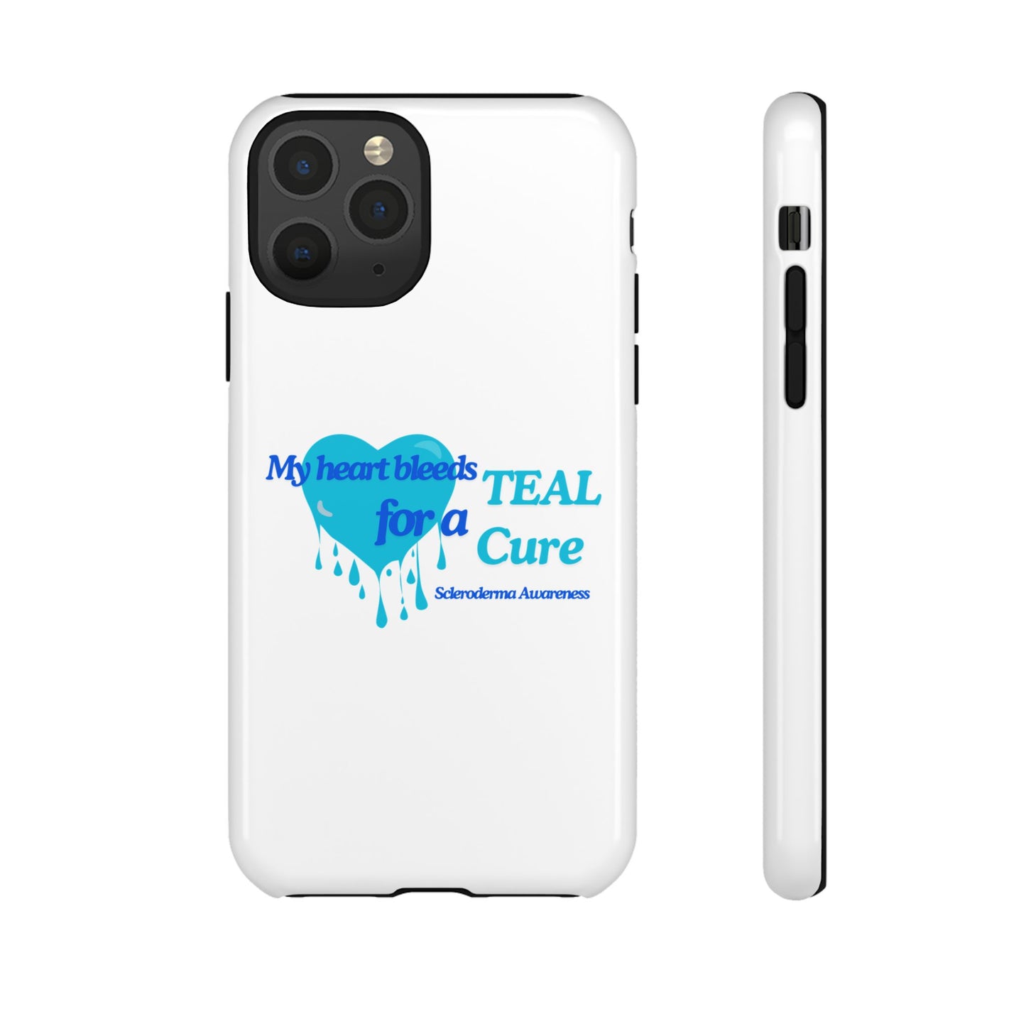 Scleroderma awareness tough iPhone case